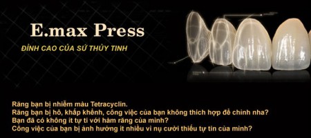 Răng sứ E.max Press co ưu điểm vượt trộ