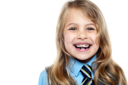 Thời điểm thích hợp để niềng răng cho trẻ em 3