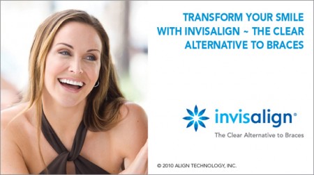 Đặc điểm của giải pháp niềng răng Invisalign 2