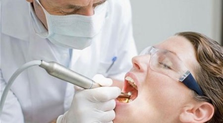 Có nên cấy ghép Implant sau khi nhổ răng 3