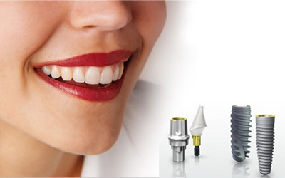 Tìm hiểu vật liệu dùng cấy ghép răng implant