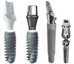 Những nguyên tắc cần biết trong cấy ghép implant