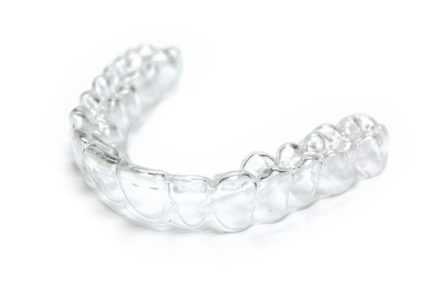 Phương pháp niềng răng không mắc cài 3D Clear