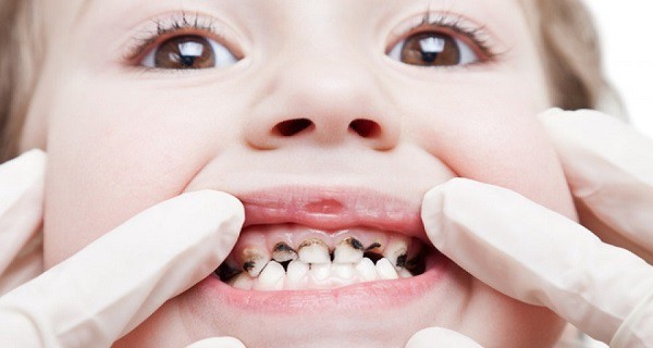 kinh nghiệm chăm sóc răng miệng cho trẻ nhỏ
