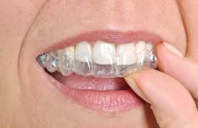 niềng răng invisalign có đau không