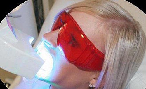 Phương pháp tẩy trắng răng bằng đèn plasma-2