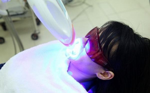 Phương pháp tẩy trắng răng bằng đèn plasma-3