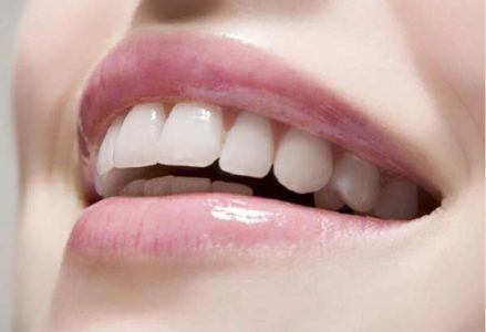 Những lợi ích tuyệt vời khi cấy ghép implant 2