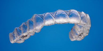 niềng răng invisalign có tốt không