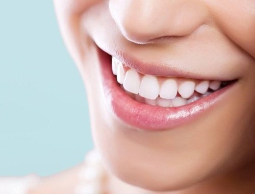 Cách bảo vệ tủy răng khi răng bị gãy mẻ 2