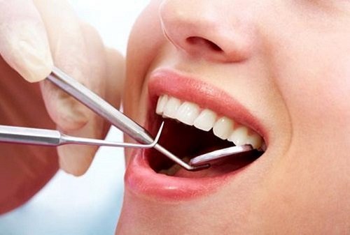 Nên bọc răng sứ hay cấy ghép implant tốt hơn? 3