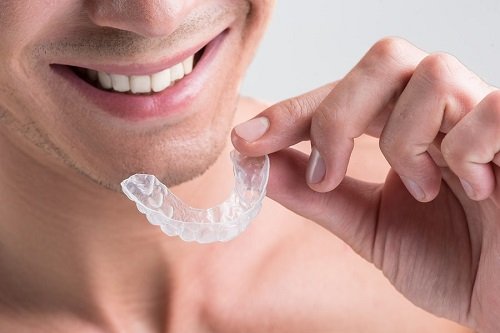 Tại sao niềng răng invisalign được khách hàng đánh giá cao? 1