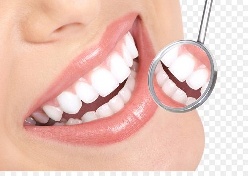 Thông tin về răng sứ ceramill - Ưu và nhược điểm 2