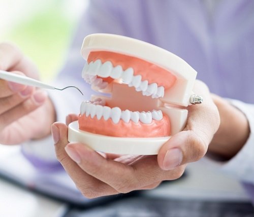 Thực hiện bọc răng hàm bị sâu có đau không? Các bước thực hiện 3