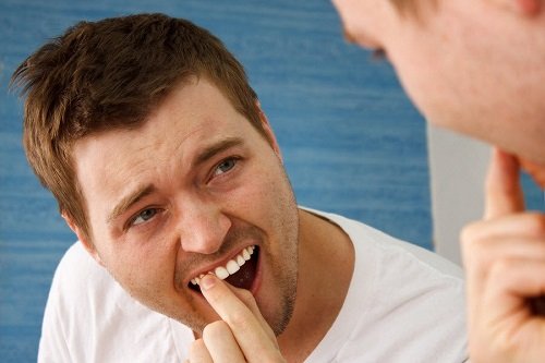 Bọc răng sứ bị cộm phải làm gì để khắc phục? 1