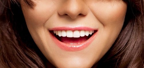 Nguyên nhân và cách khắc phục bọc răng sứ bị thâm lợi 3