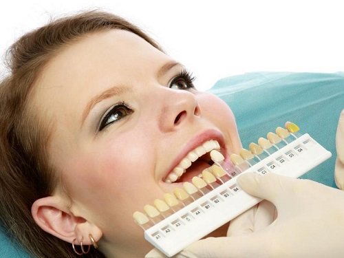 Bọc răng sứ titan có tốt không? Lý giải từ nha khoa 3