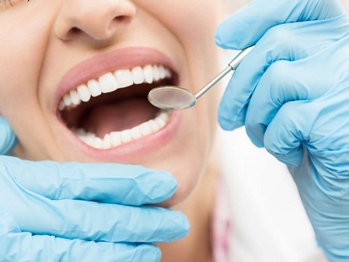 Làm răng sứ cả hàm cần nắm bắt gì trước khi thực hiện? 2