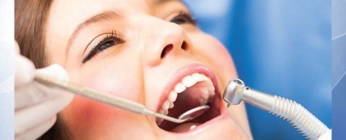 Niềng răng bị lòi chân răng- Cách khắc phục triệt để 2