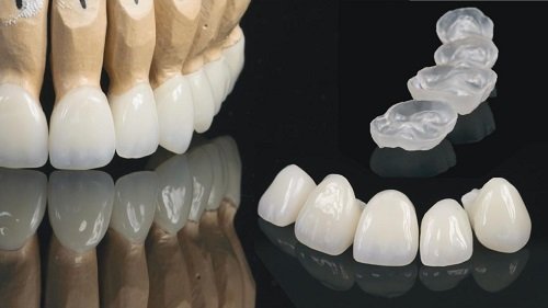 Cách khắc phục tình trạng răng sứ bị xỉn màu 2