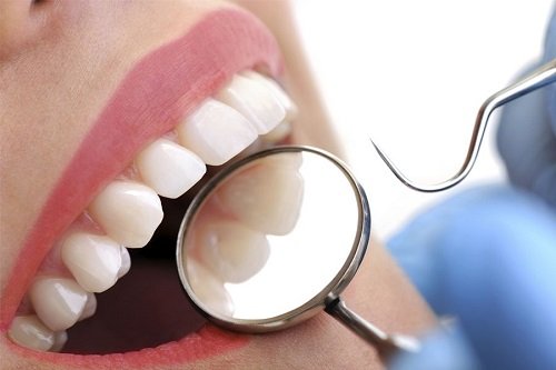 Bọc răng sứ chỉnh hô khắc phục thẩm mỹ cao 2