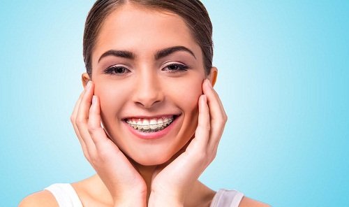 Tìm hiểu về niềng răng lệch hàm tại nha khoa 3