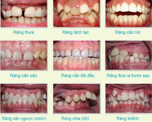 Top 3 địa chỉ niềng răng tại Cần Thơ - Bạn nên tham khảo ngay 2