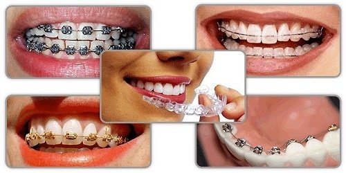 Top 3 địa chỉ niềng răng tại Cần Thơ - Bạn nên tham khảo ngay 4