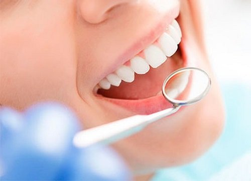 Có nên tẩy trắng răng nhiều lần không bác sĩ? 1