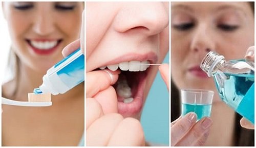 Có nên tẩy trắng răng nhiều lần không bác sĩ? 4