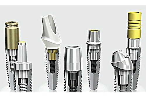 Kinh nghiệm làm răng implant của bạn Hà Thanh 3